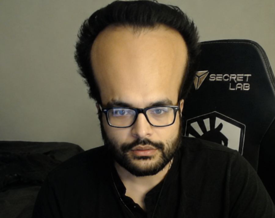 kurumx, and his legendary forehead