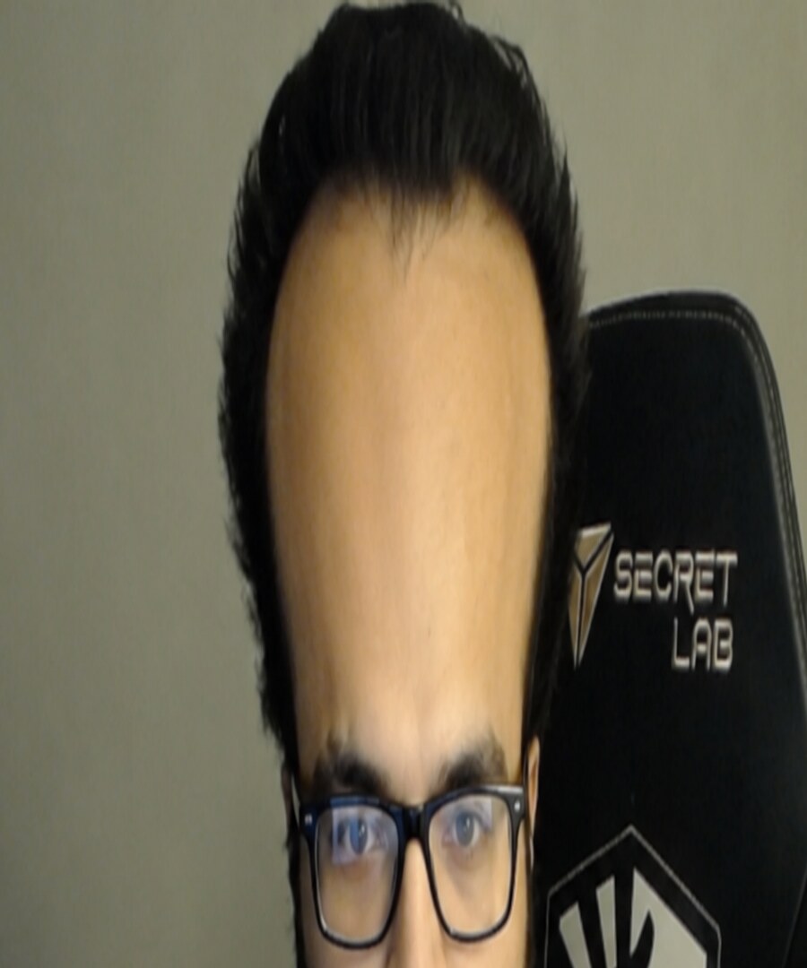 kurumx with a tetris well sunk into his forehead